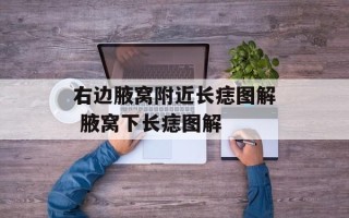 右边腋窝附近长痣图解 腋窝下长痣图解