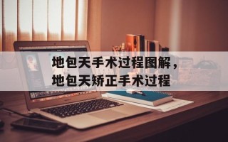 地包天手术过程图解，地包天矫正手术过程