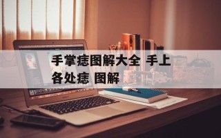 手掌痣图解大全 手上各处痣 图解