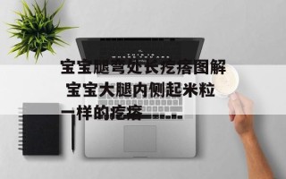 宝宝腿弯处长疙瘩图解 宝宝大腿内侧起米粒一样的疙瘩