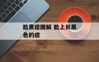 脸黑痣图解 脸上长黑色的痣