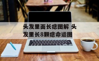 头发里面长痣图解 头发里长8颗痣命运图