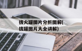 拔火罐图片分析图解(拔罐图片大全讲解)