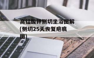 高锰酸钾侧切坐浴图解(侧切25天恢复疤痕图)