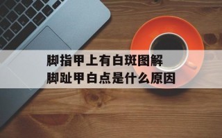 脚指甲上有白斑图解 脚趾甲白点是什么原因