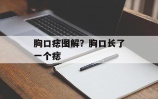 胸口痣图解？胸口长了一个痣