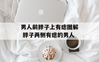 男人前脖子上有痣图解 脖子两侧有痣的男人