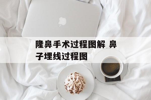 隆鼻手术过程图解 鼻子埋线过程图-第1张图片-